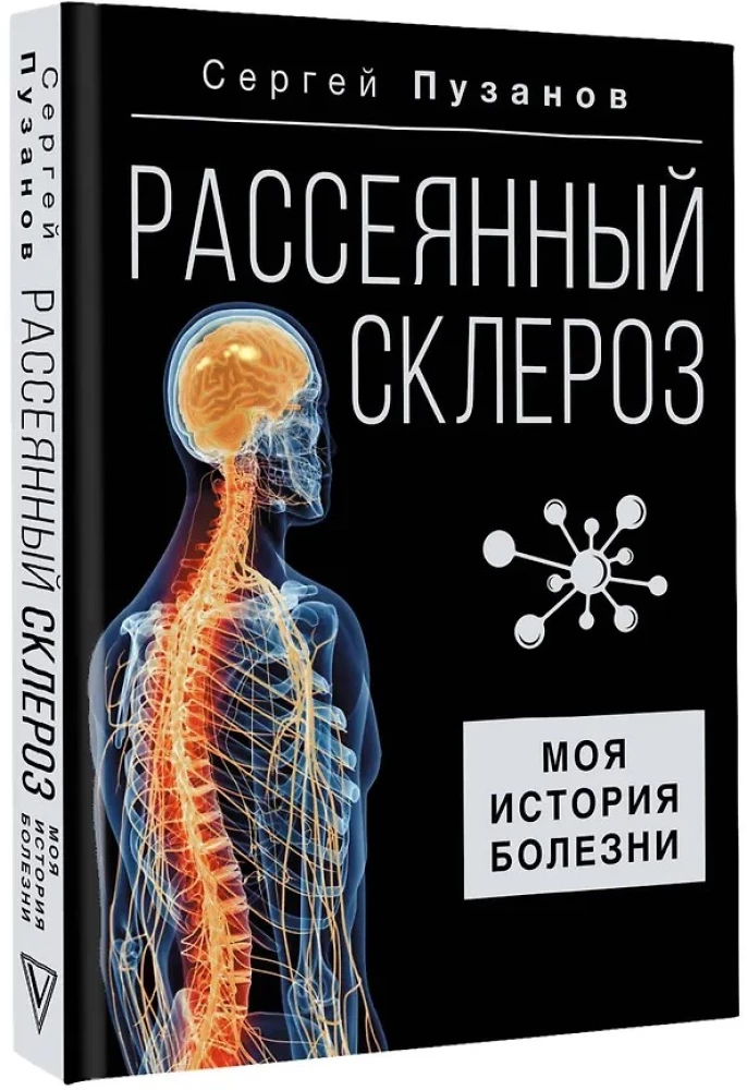 Рассеянный склероз. Моя история болезни