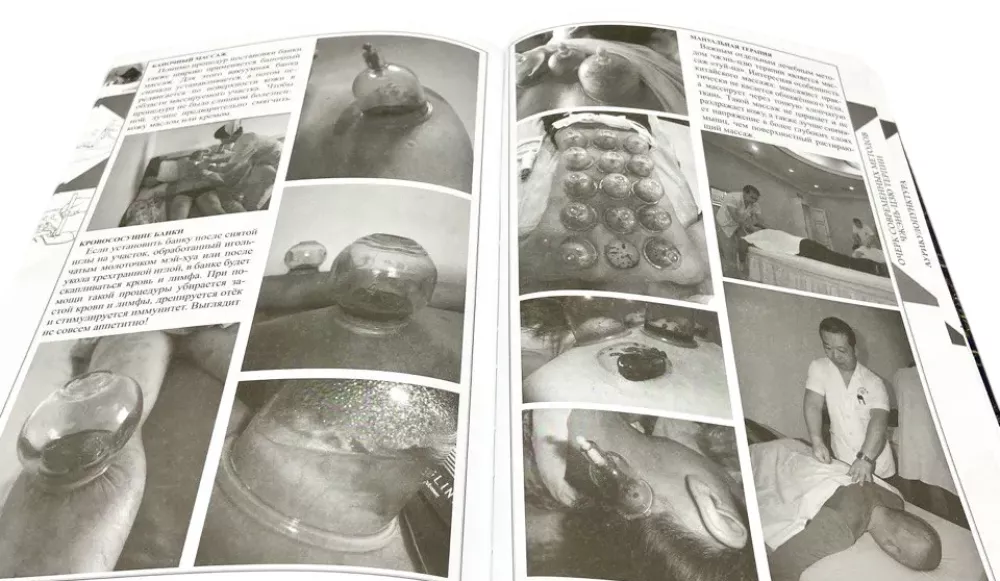 Theory and practice of classical Chinese medicine. Volume 2. Guide to acupuncture and moxibustion