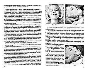 Speech Therapy Massage for Different Forms of Dysarthria