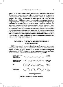 The Application of Neuroscience in Trauma Therapy: Creative and Compassionate Counseling