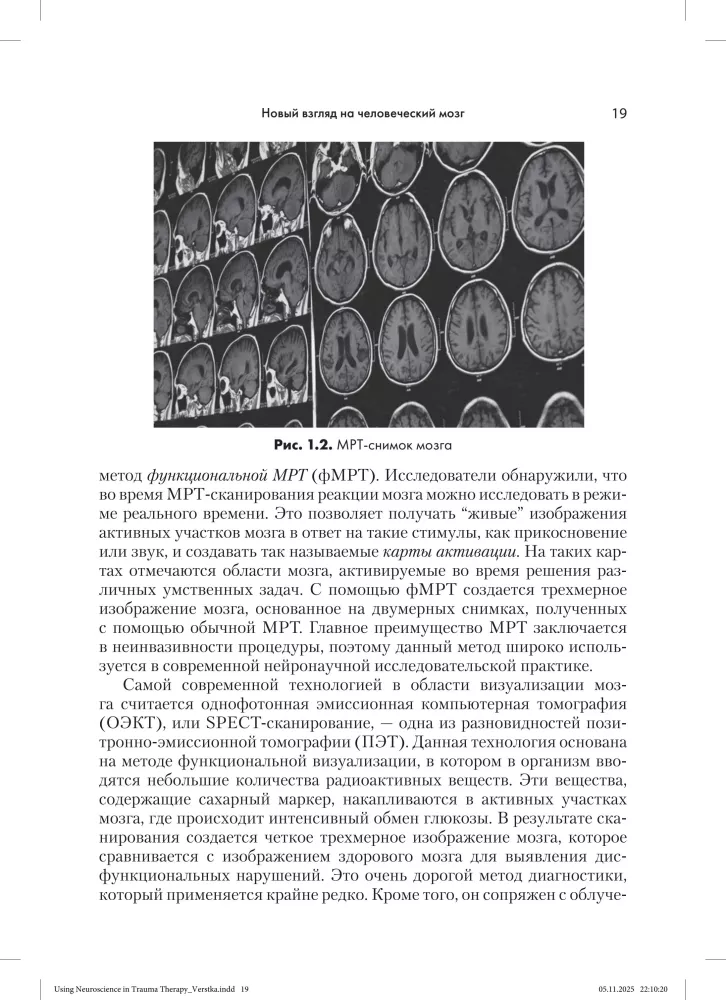 The Application of Neuroscience in Trauma Therapy: Creative and Compassionate Counseling