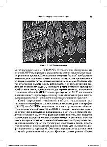 The Application of Neuroscience in Trauma Therapy: Creative and Compassionate Counseling