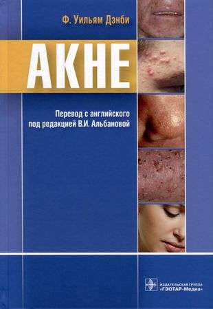 Akne