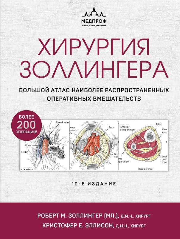 Zollinger ķirurģija. Liels atlas visbiežāk sastopamajiem operatīvajiem iejaukšanās gadījumiem