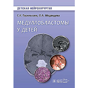 Medulloblastomas bērniem