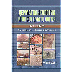 Dermatoloģiskā onkoloģija un onkoloģiskā hematoloģija