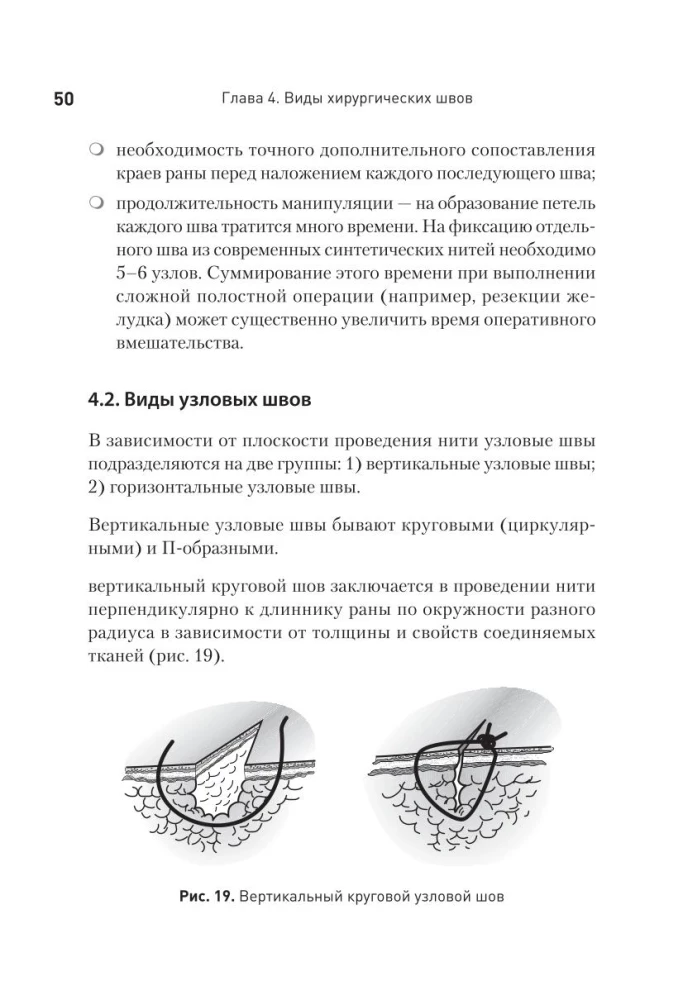 Surgical Suture