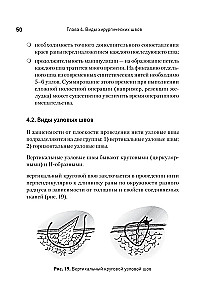 Surgical Suture