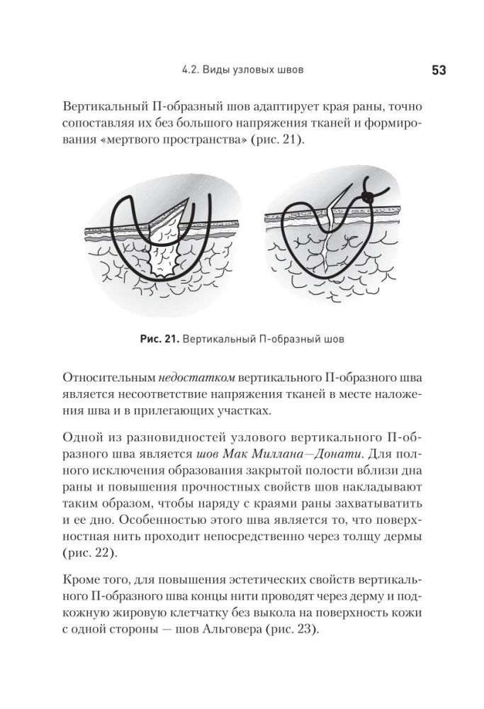 Surgical Suture