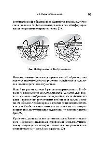 Surgical Suture