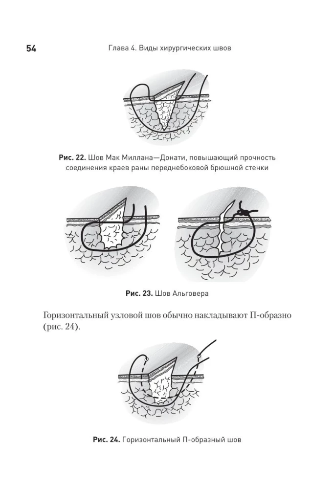 Surgical Suture