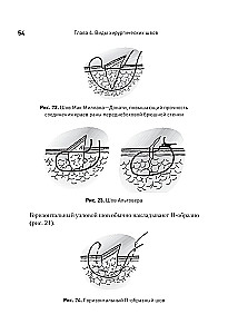 Surgical Suture