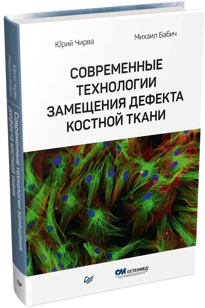 Modern Technologies for Bone Tissue Defect Replacement