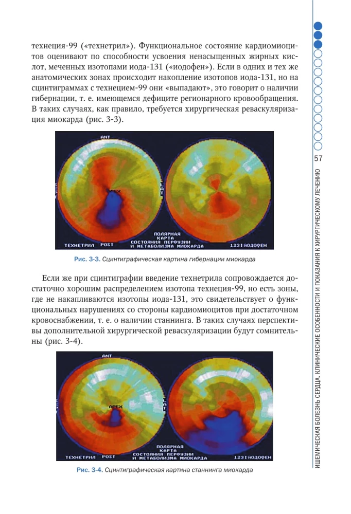Clinical Aspects of Cardiovascular Surgery