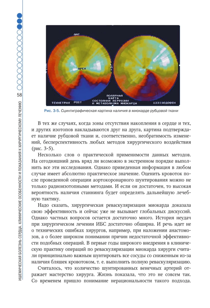 Clinical Aspects of Cardiovascular Surgery