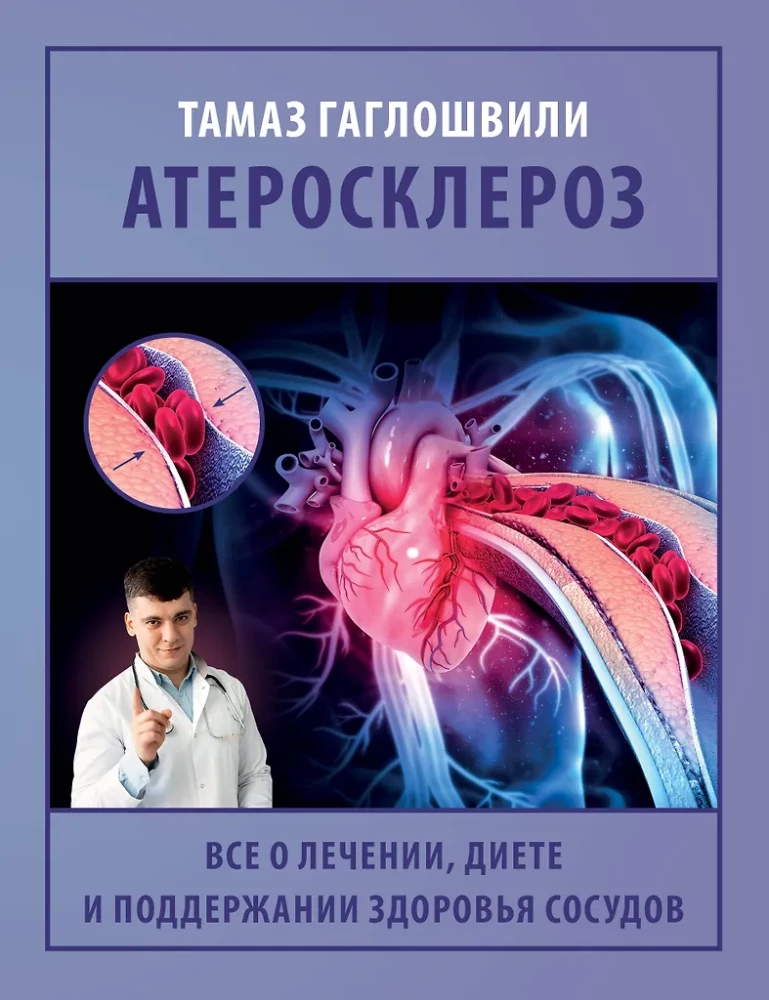 Atherosclerosis. All about treatment, diet, and maintaining vascular health