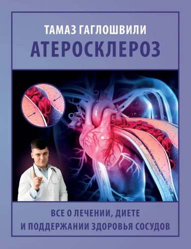 Atherosclerosis. All about treatment, diet, and maintaining vascular health