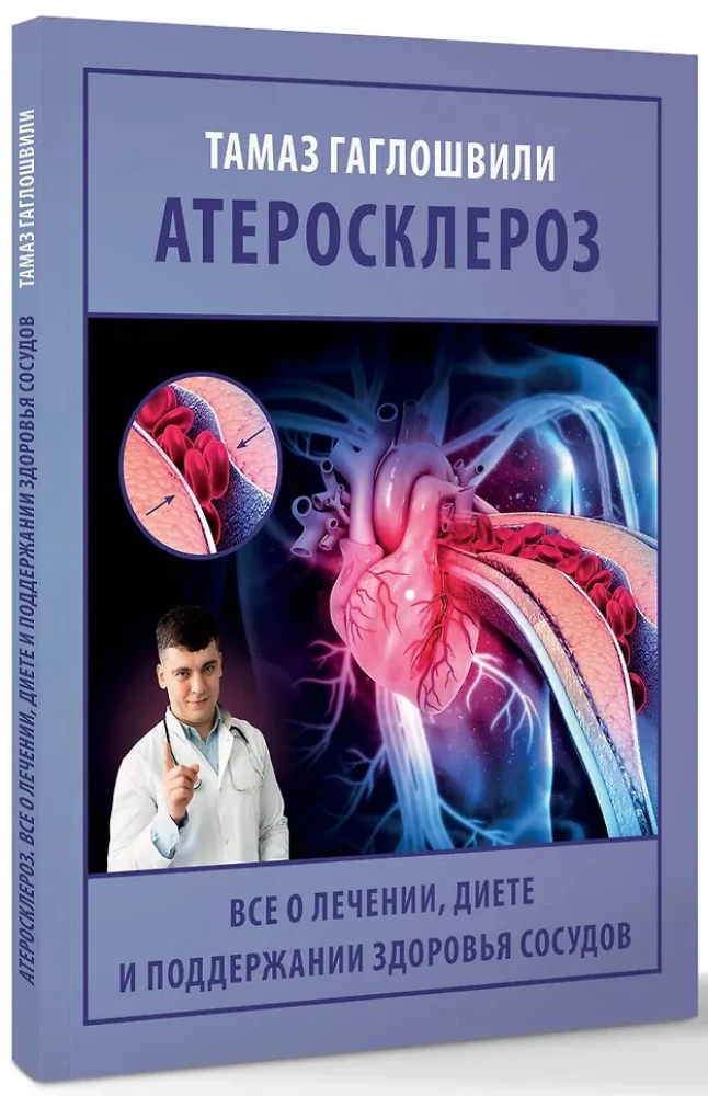 Atherosclerosis. All about treatment, diet, and maintaining vascular health