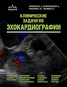 Kliinilised ülesanded ehhokardiograafias